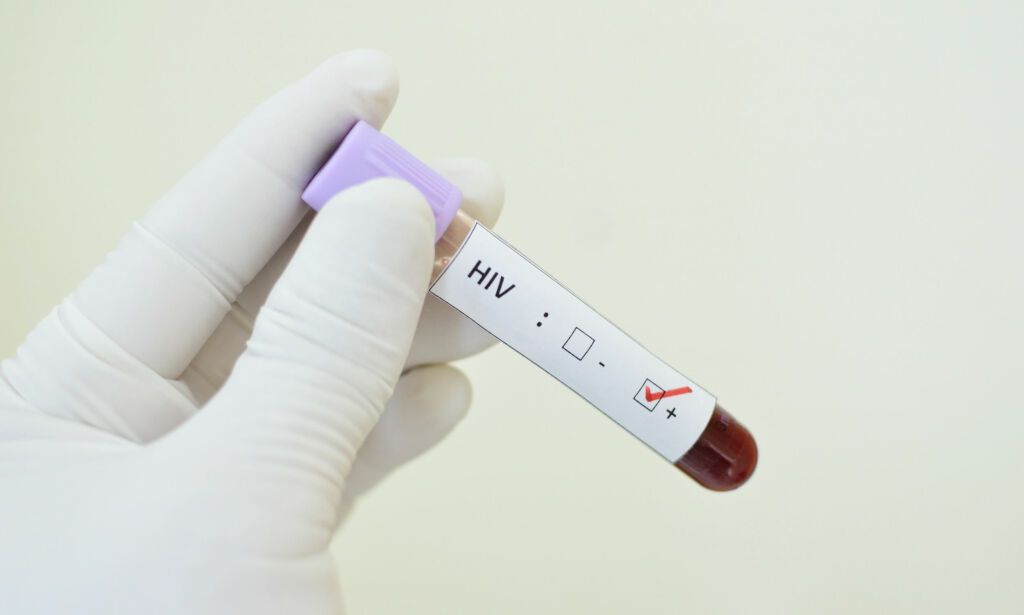Russere benekter landets alvorlige hiv-problem - hevder det er vestlig konspirasjon